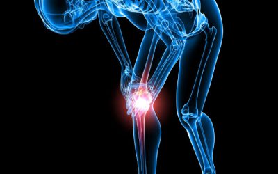 Avoid a Knee Replacement in Camp Hill PA and Personalize Healing