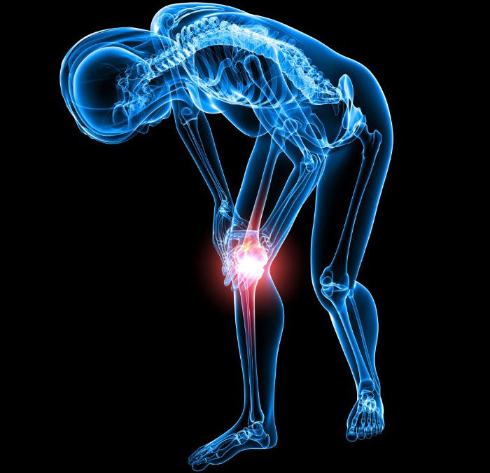 Avoid a Knee Replacement in Camp Hill PA and Personalize Healing