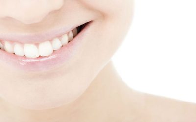 Top Teeth Whitening Dentist Fort Myers FL: Brighten Your Smile Today